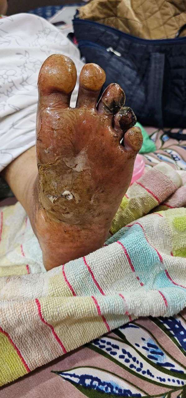 Clinical image 3 from Merina Medical Centre case record
