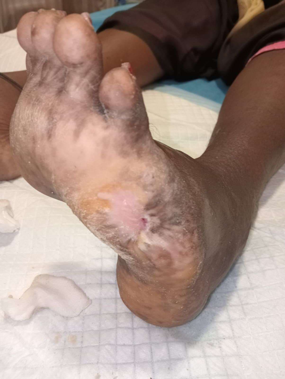 Clinical image 2 from Merina Medical Centre case record