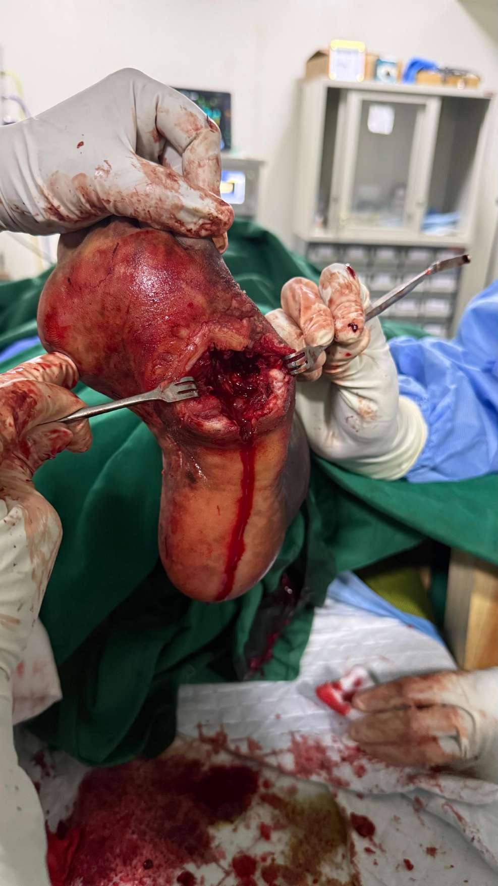 Clinical image 3 from Merina Medical Centre case record