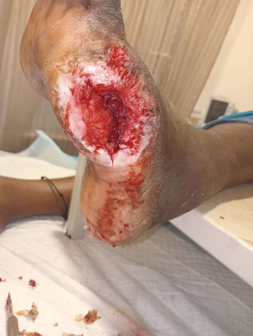 Clinical image 4 from Merina Medical Centre case record