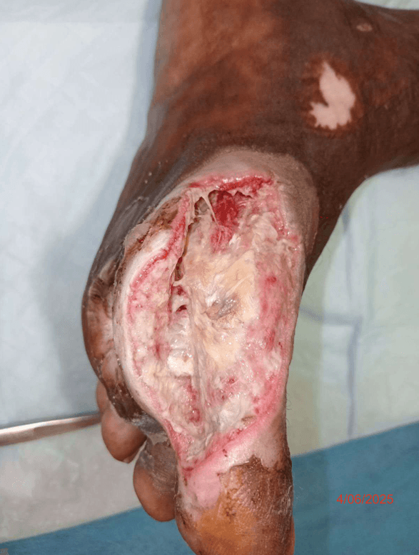 Clinical image 3 from Merina Medical Centre case record