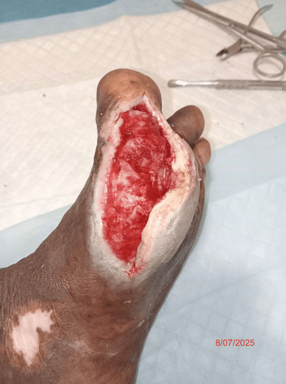 Clinical image 5 from Merina Medical Centre case record