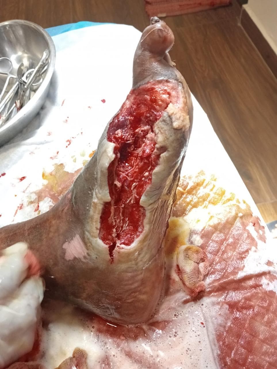 Clinical image 2 from Merina Medical Centre case record