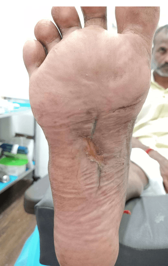Clinical image 4 from Merina Medical Centre case record