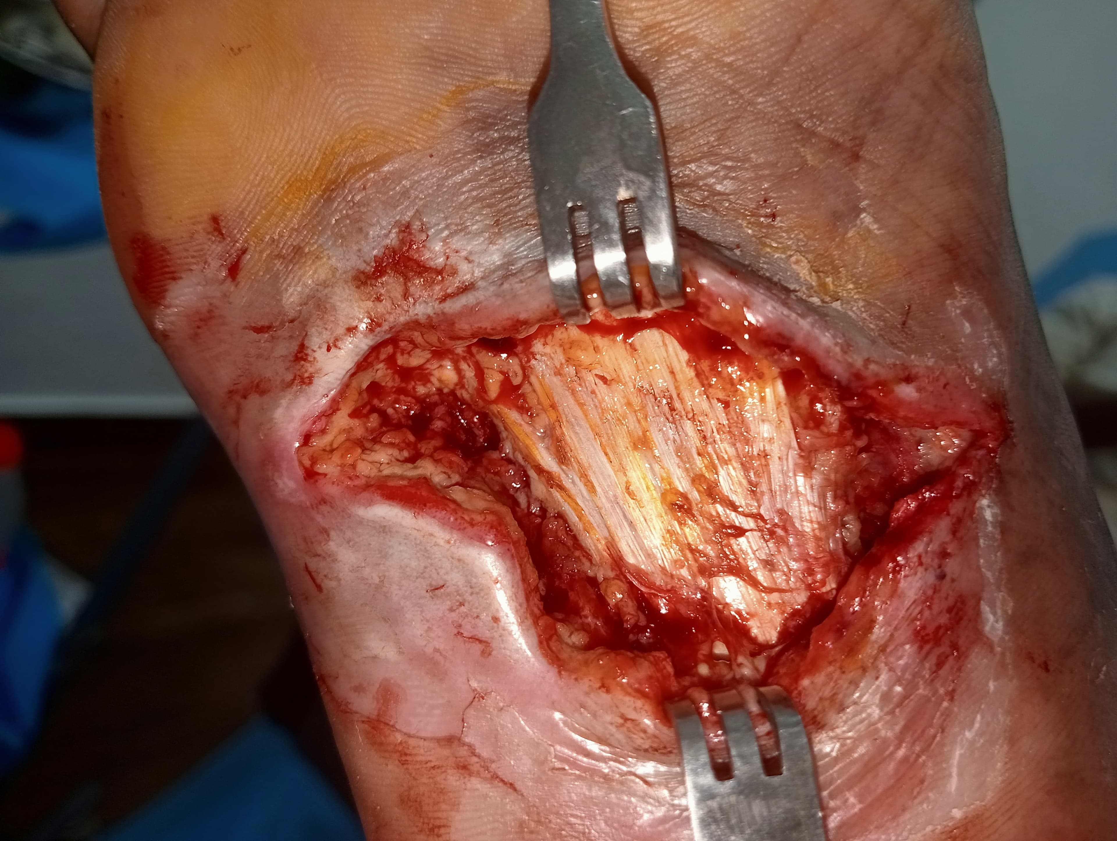 Clinical image 5 from Merina Medical Centre case record
