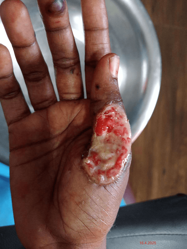 Clinical image 1 from Merina Medical Centre case record