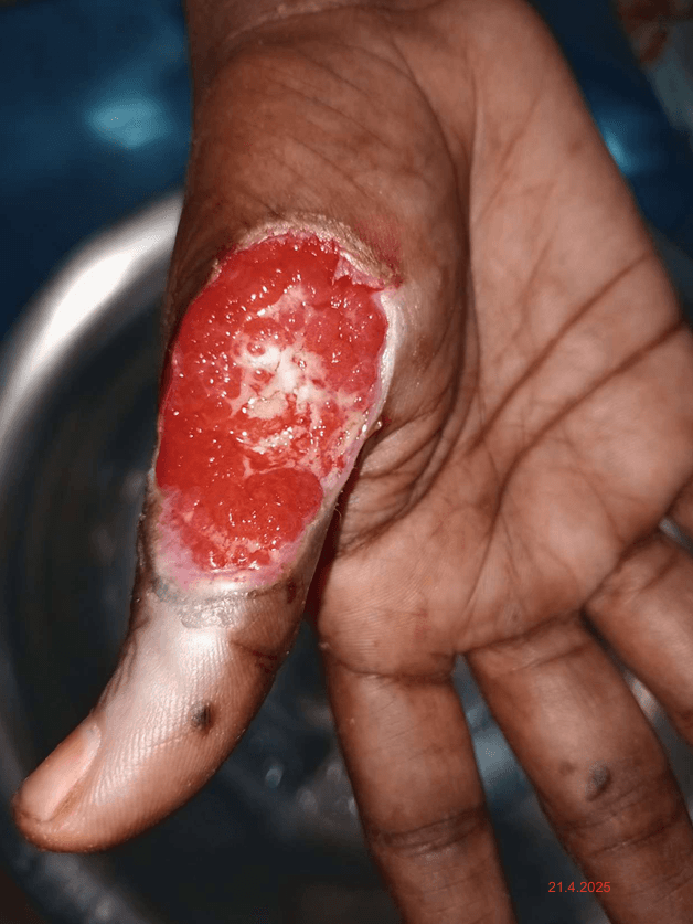 Clinical image 2 from Merina Medical Centre case record