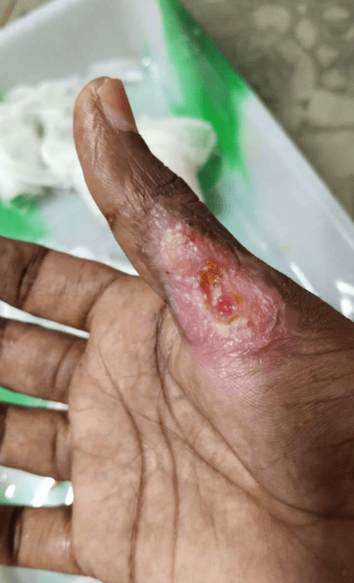 Clinical image 3 from Merina Medical Centre case record