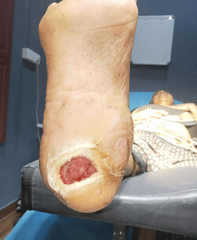 Clinical image 2 from Merina Medical Centre case record