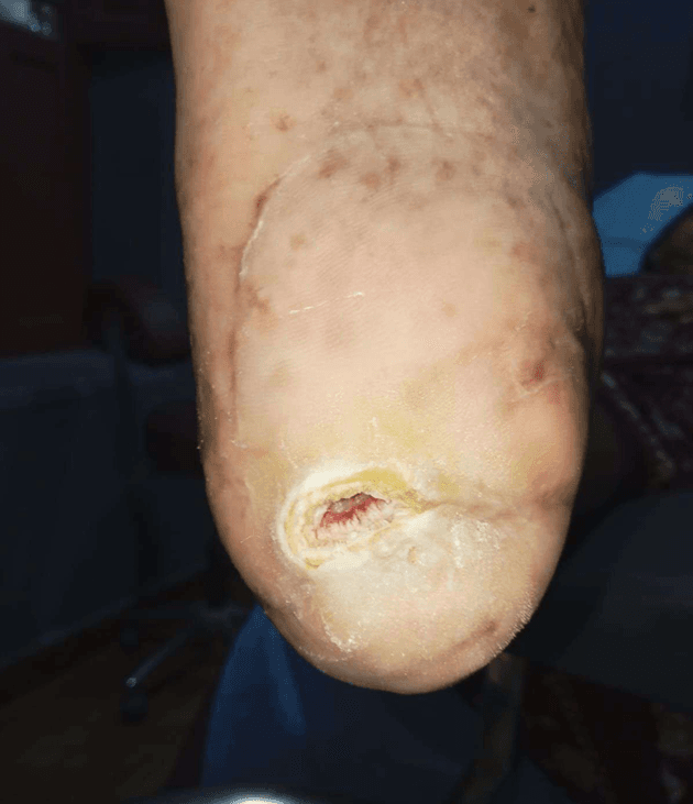 Clinical image 4 from Merina Medical Centre case record