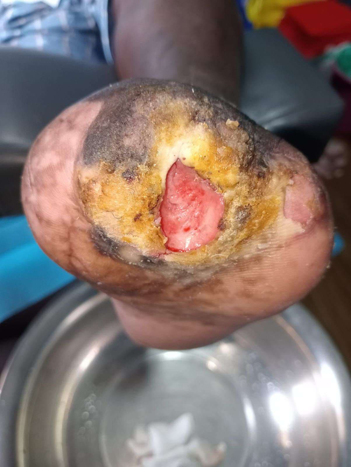 Clinical image 1 from Merina Medical Centre case record