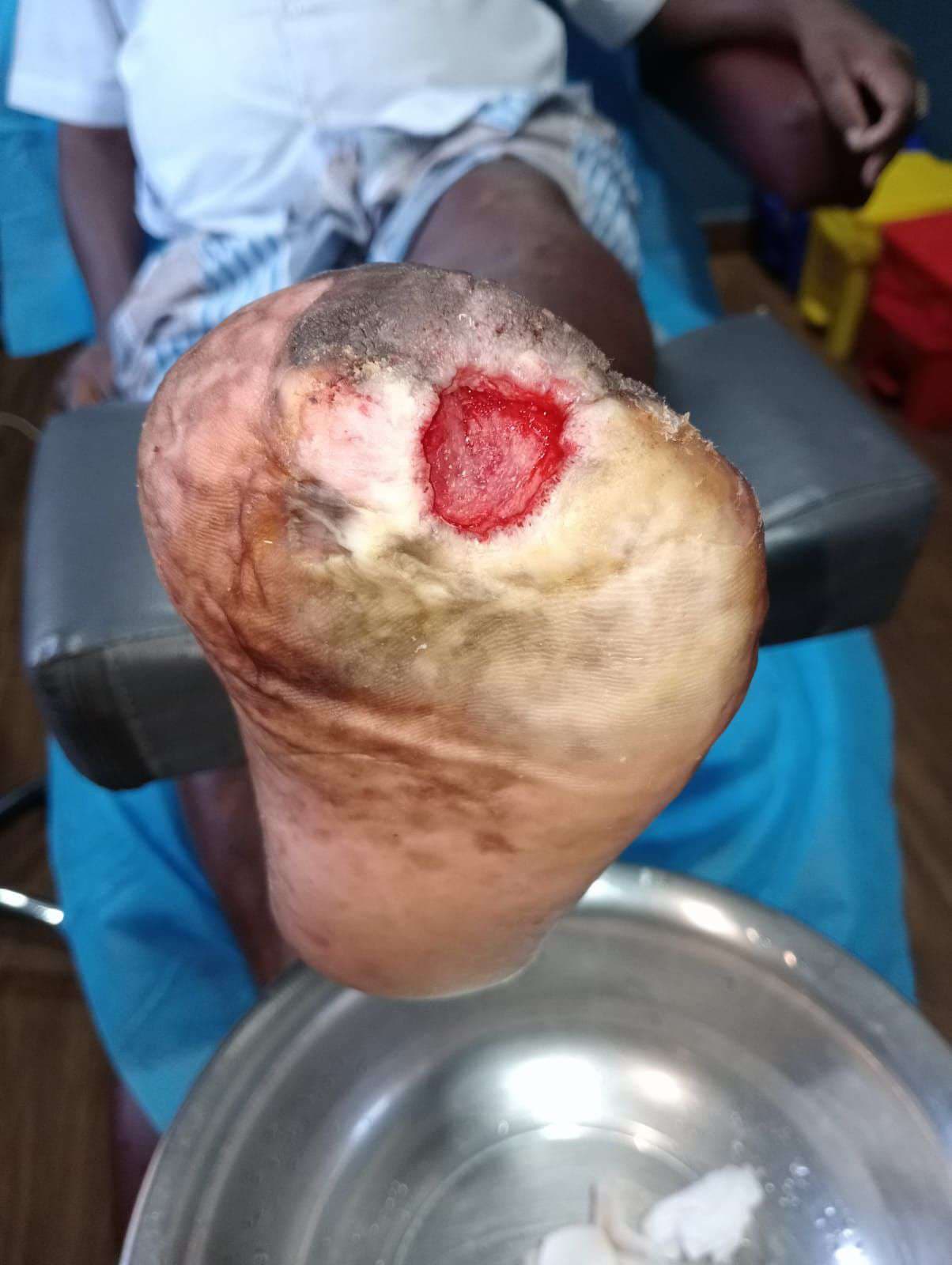 Clinical image 3 from Merina Medical Centre case record