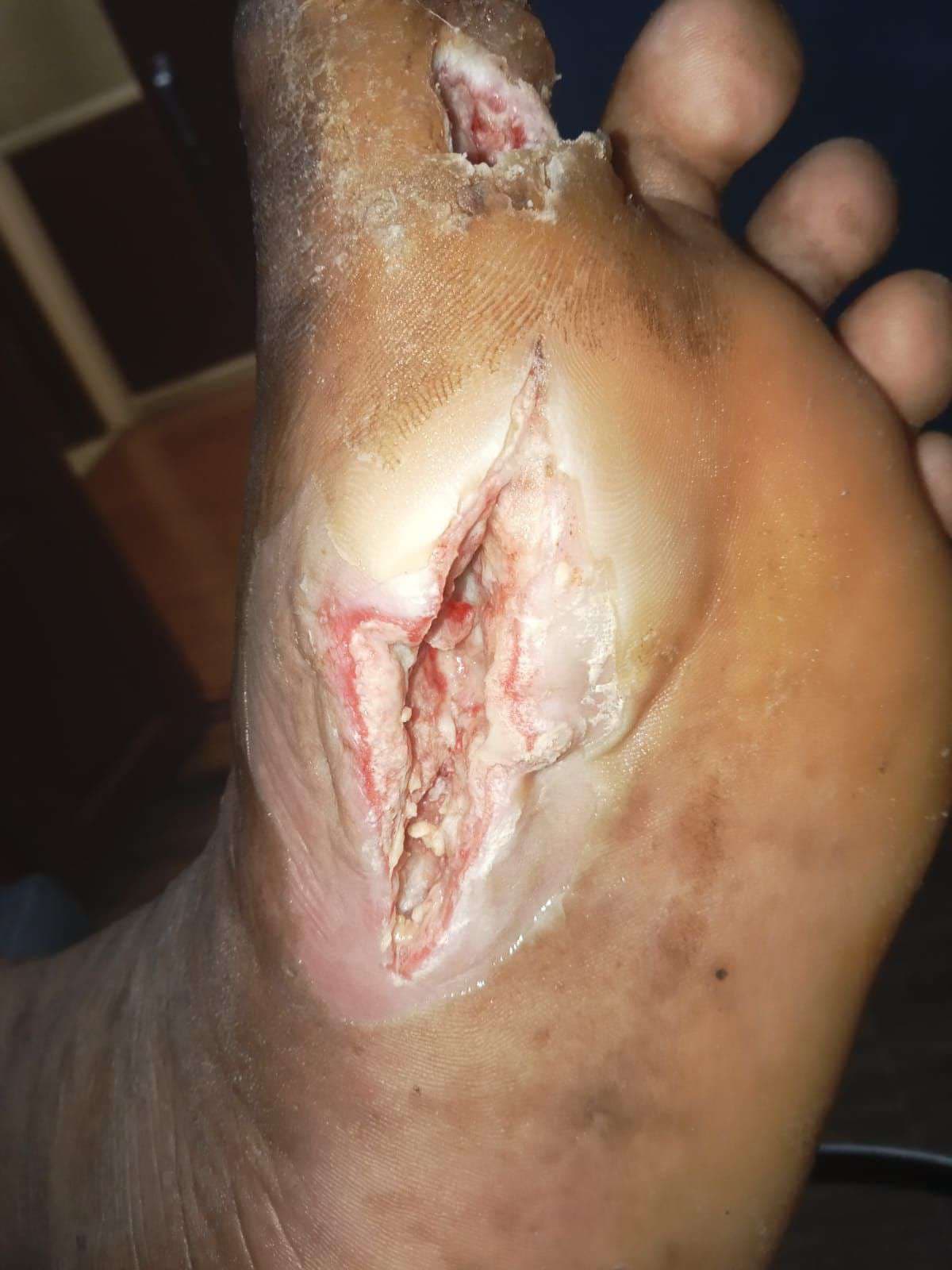 Clinical image 1 from Merina Medical Centre case record