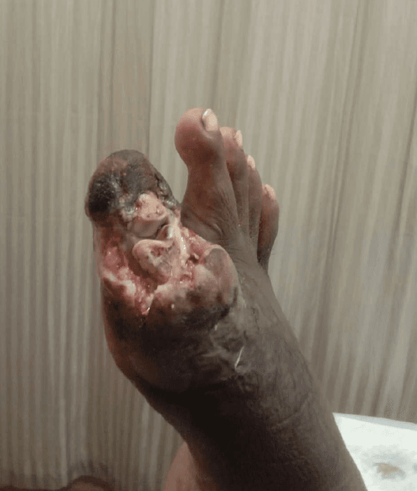 Clinical image 1 from Merina Medical Centre case record