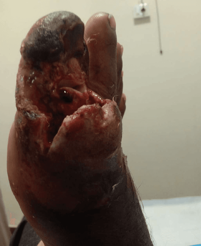 Clinical image 2 from Merina Medical Centre case record