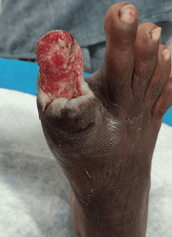 Clinical image 3 from Merina Medical Centre case record