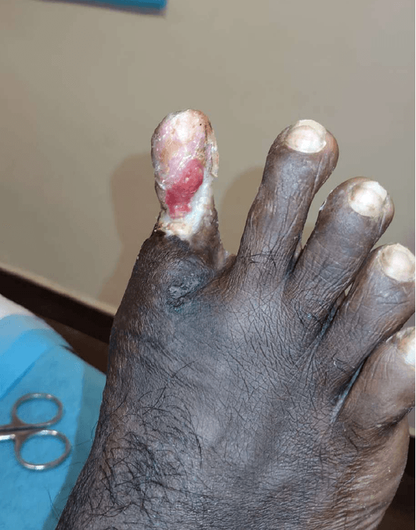 Clinical image 4 from Merina Medical Centre case record