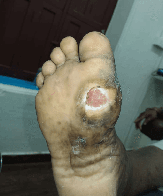 Clinical image 1 from Merina Medical Centre case record