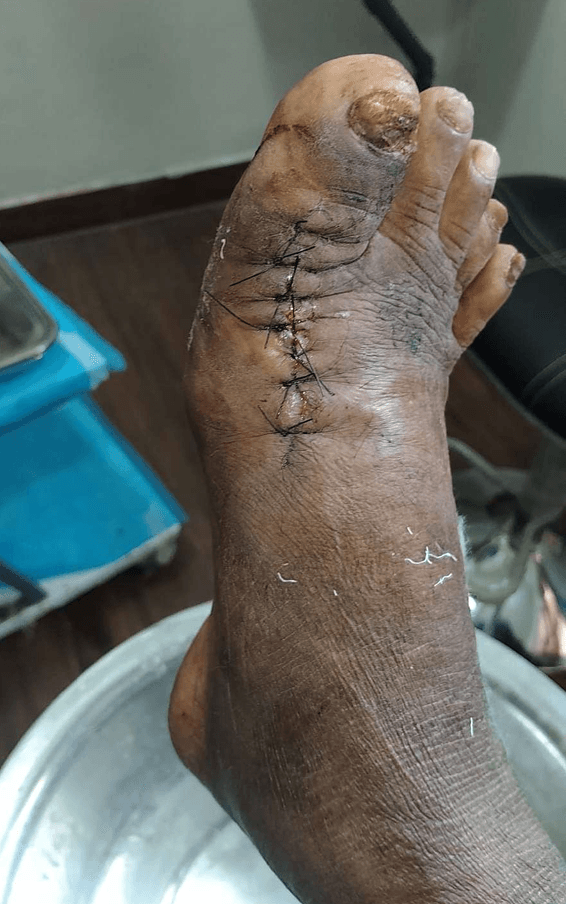 Clinical image 5 from Merina Medical Centre case record