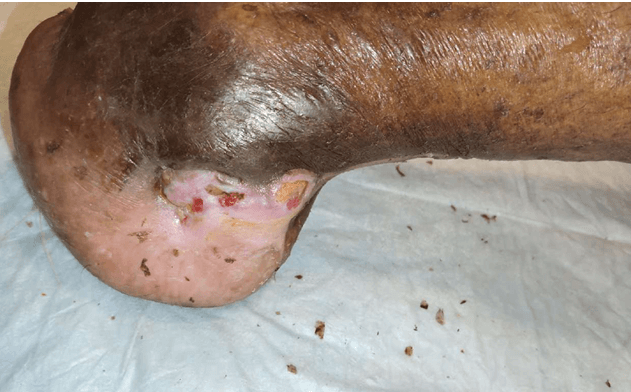Clinical image 1 from Merina Medical Centre case record
