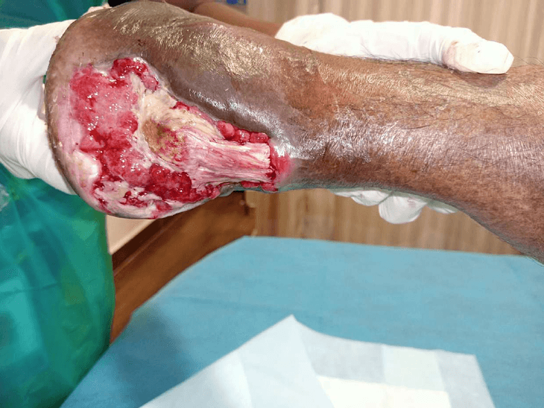 Clinical image 2 from Merina Medical Centre case record