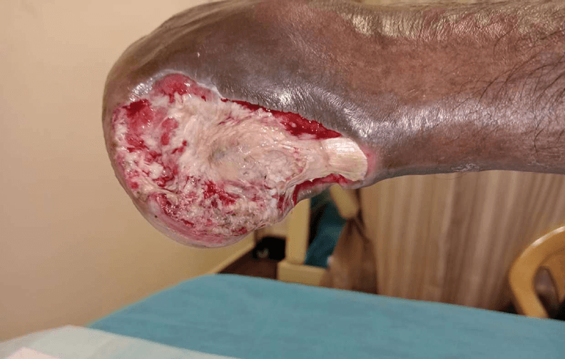 Clinical image 3 from Merina Medical Centre case record