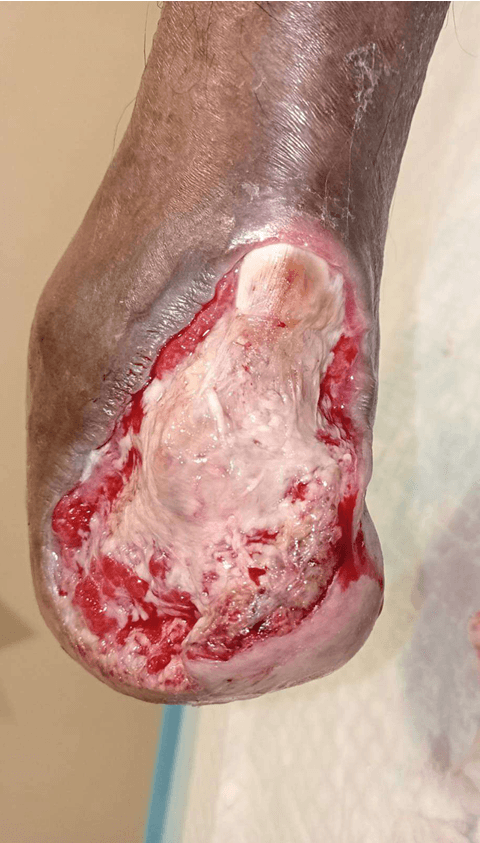 Clinical image 4 from Merina Medical Centre case record