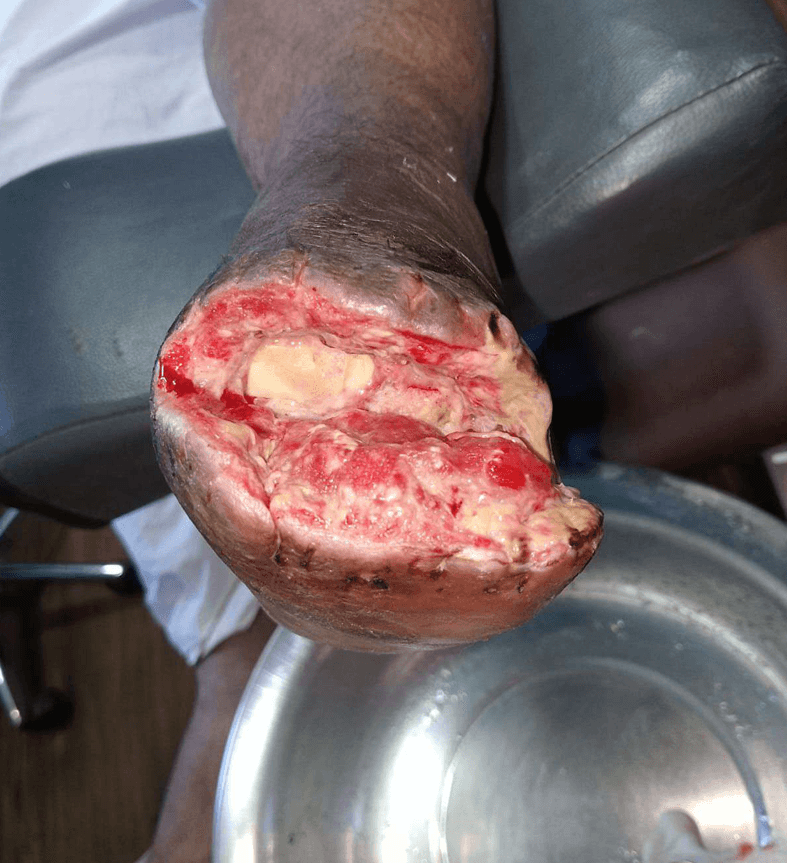 Clinical image 1 from Merina Medical Centre case record