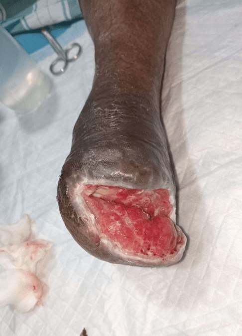 Clinical image 3 from Merina Medical Centre case record