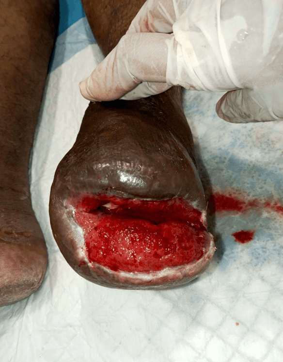 Clinical image 4 from Merina Medical Centre case record