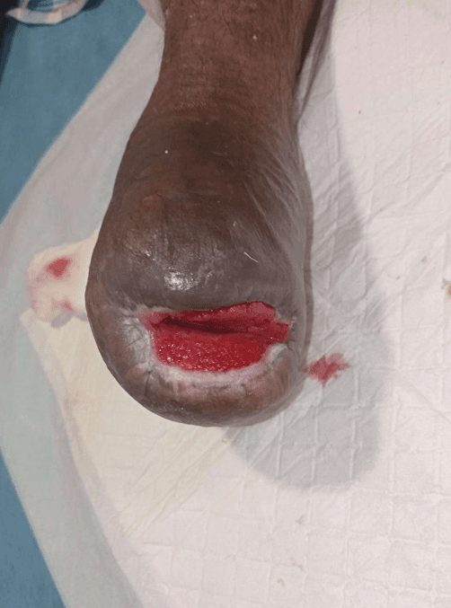 Clinical image 5 from Merina Medical Centre case record