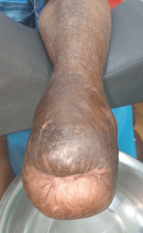 Clinical image 6 from Merina Medical Centre case record
