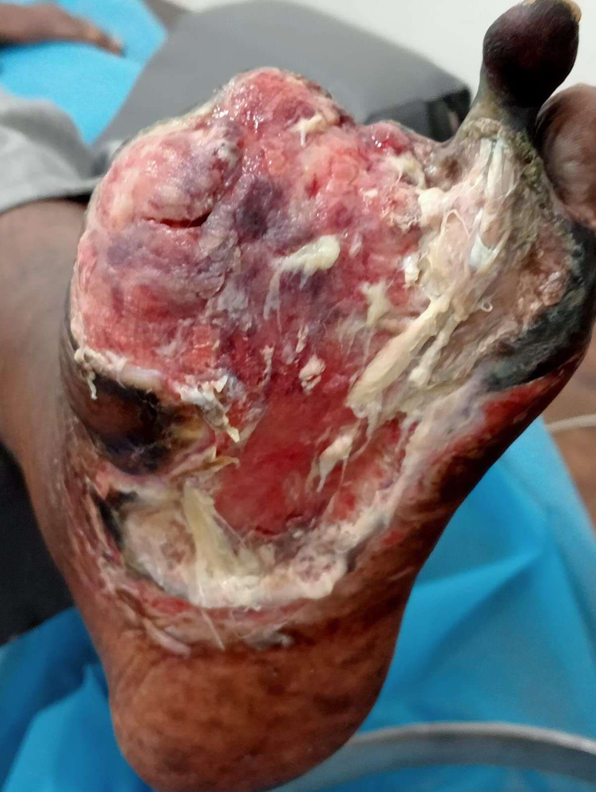 Clinical image 1 from Merina Medical Centre case record
