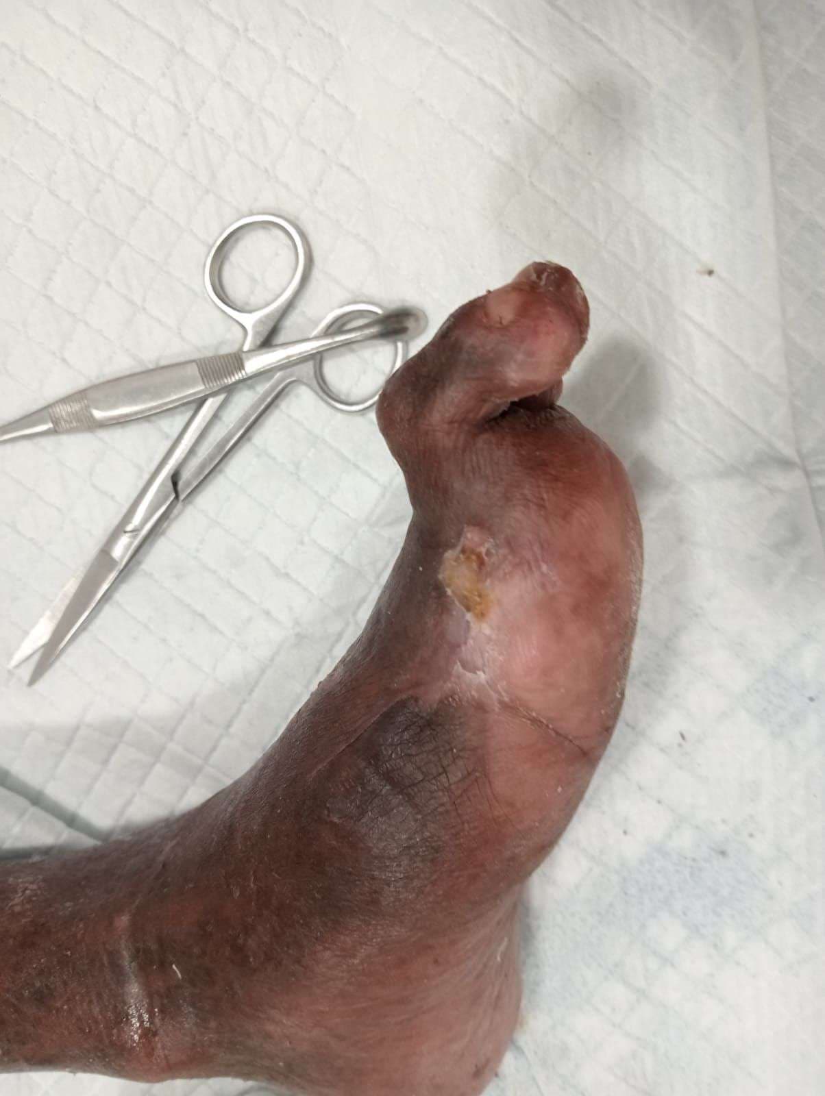 Clinical image 2 from Merina Medical Centre case record