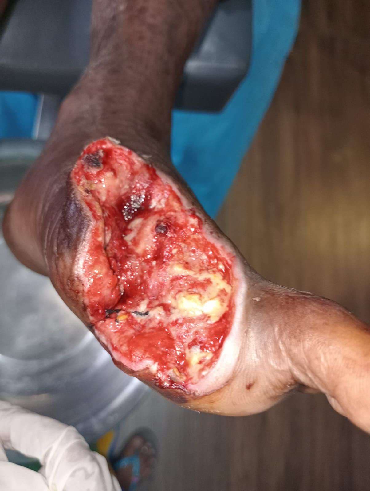 Clinical image 3 from Merina Medical Centre case record