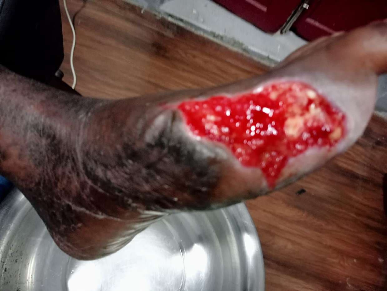 Clinical image 5 from Merina Medical Centre case record