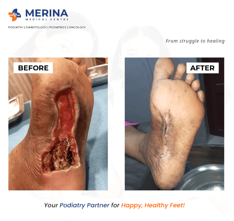Clinical image 1 from Merina Medical Centre case record