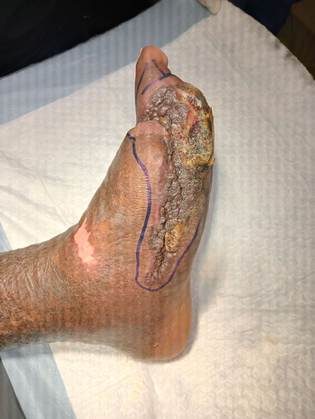 Clinical image 1 from Merina Medical Centre case record