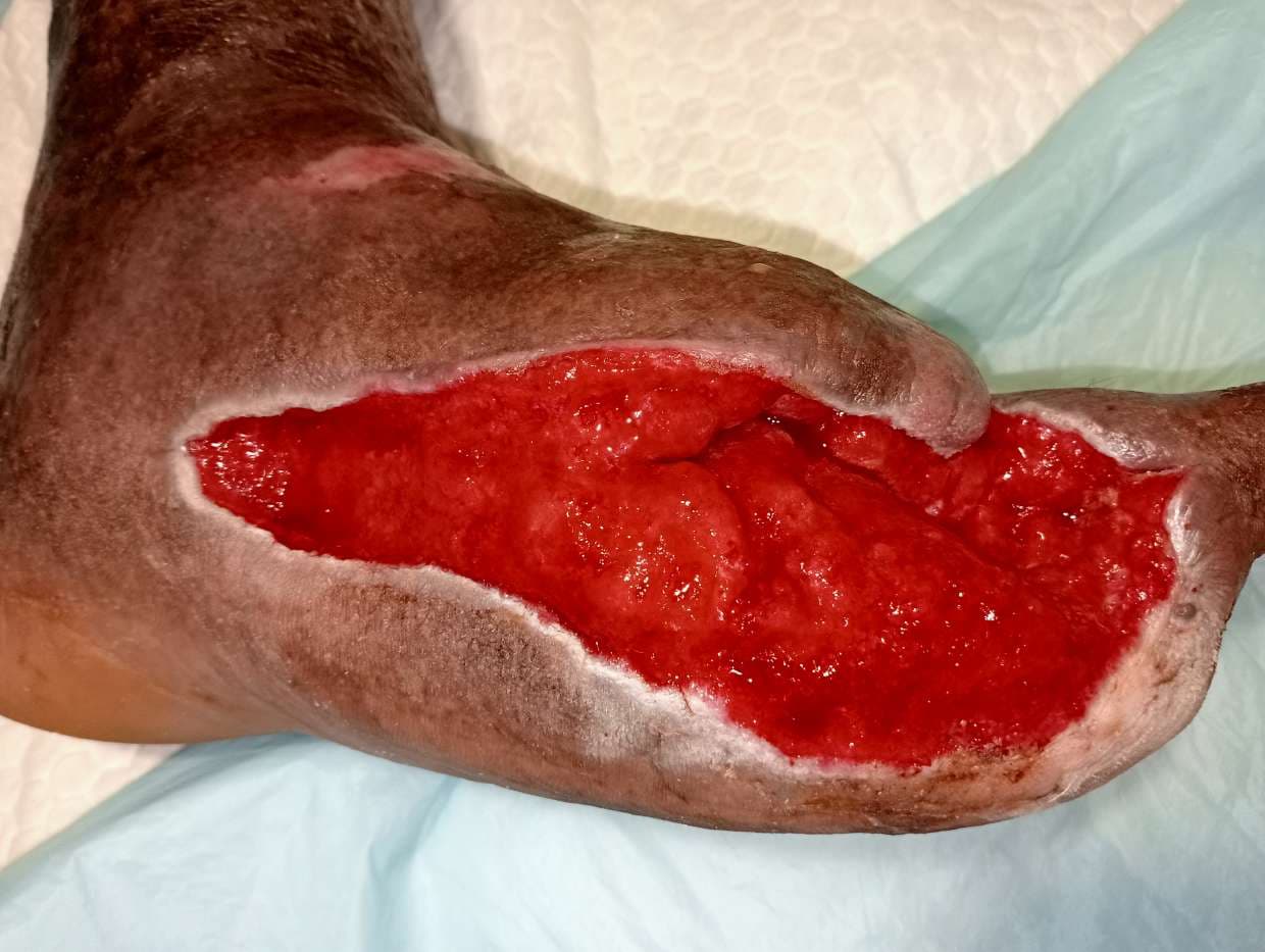 Clinical image 5 from Merina Medical Centre case record