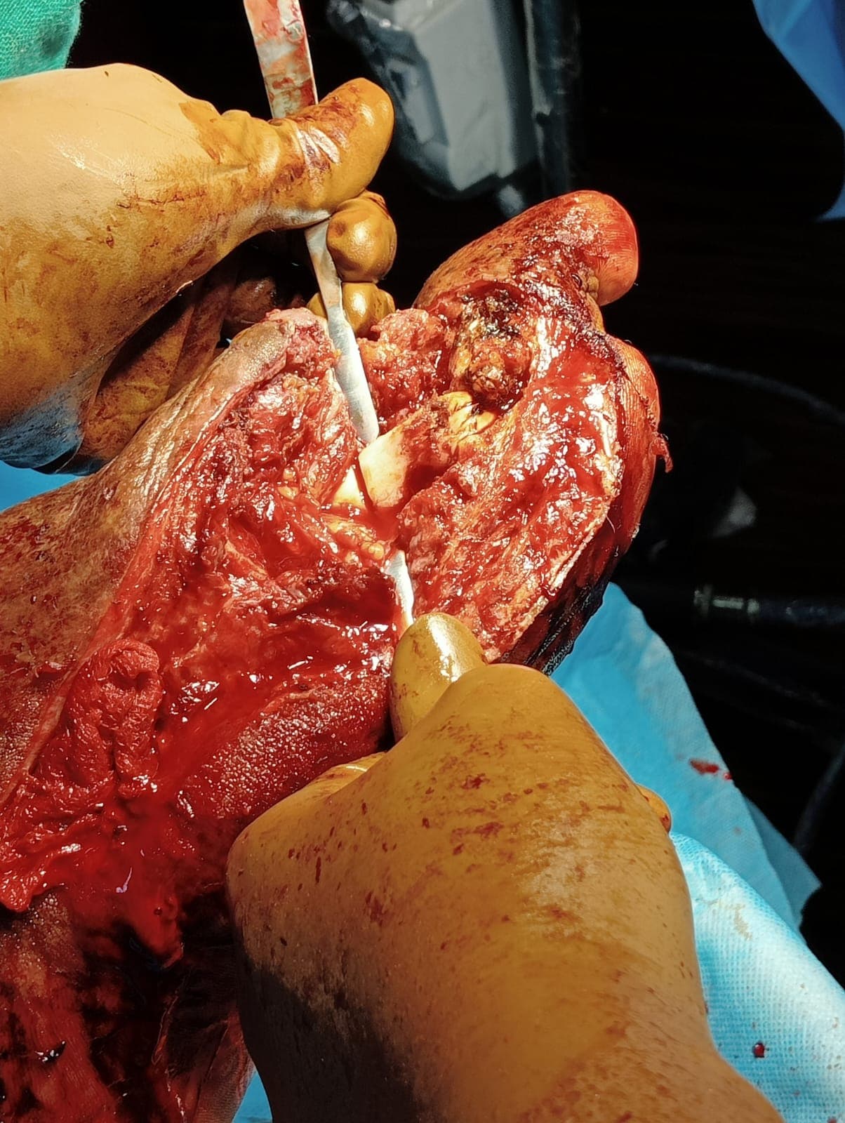 Clinical image 6 from Merina Medical Centre case record