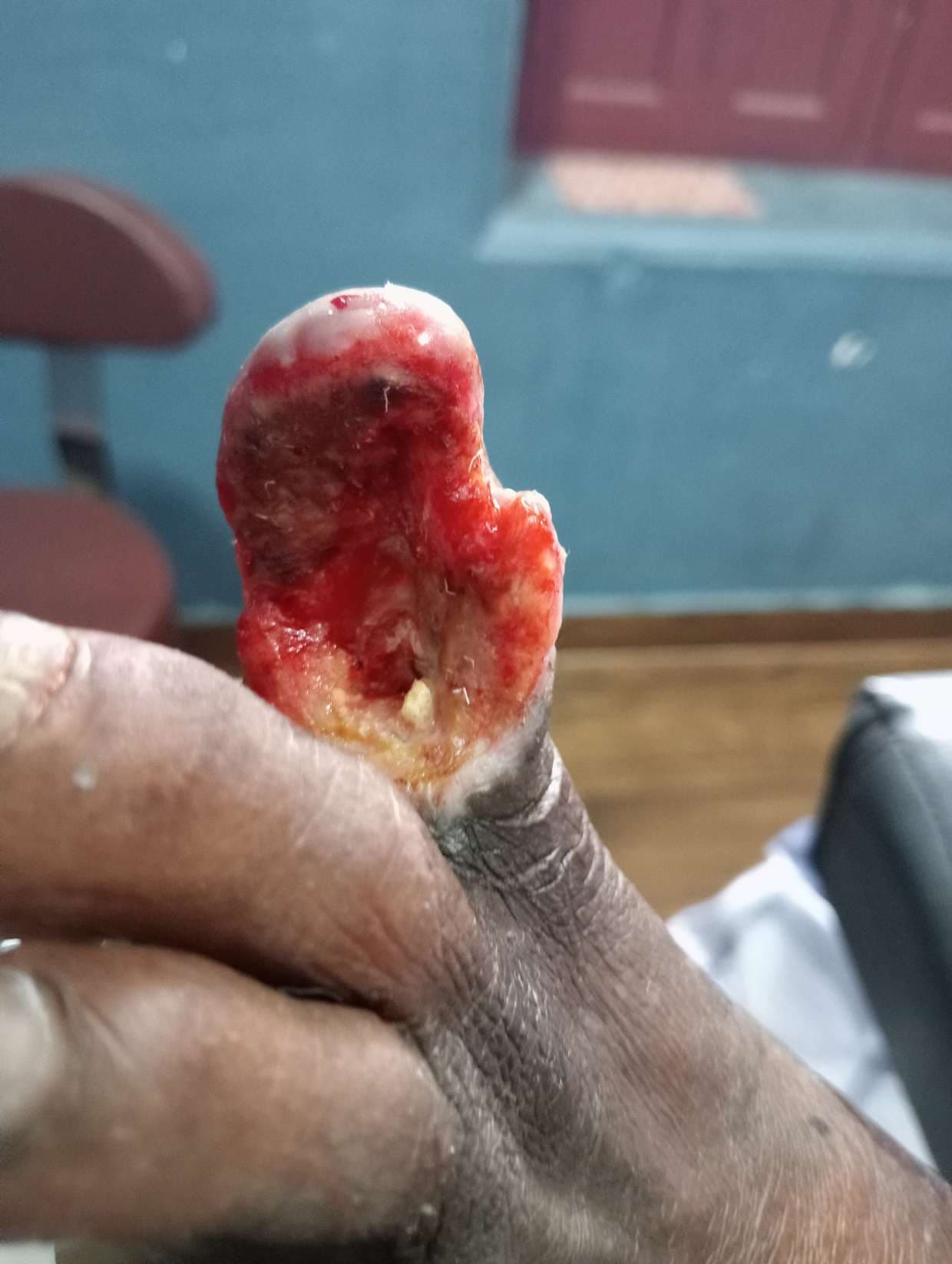 Clinical image 1 from Merina Medical Centre case record