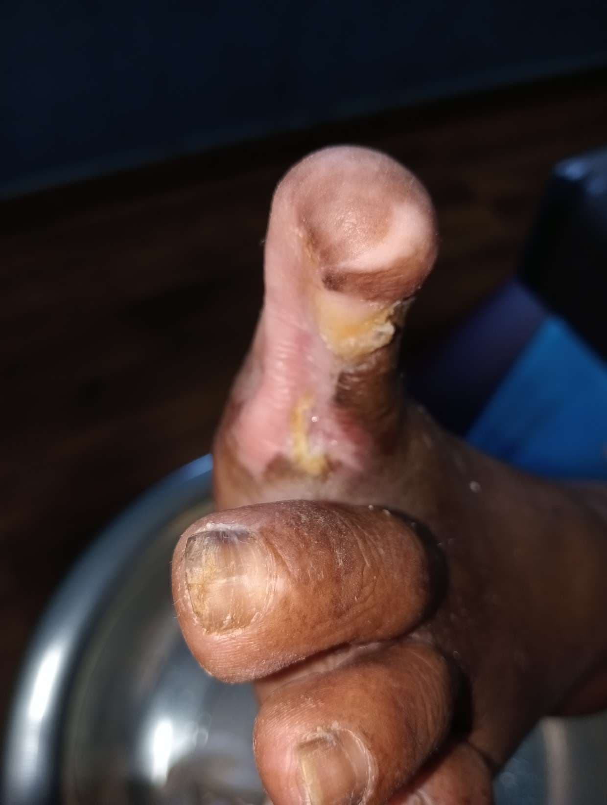 Clinical image 2 from Merina Medical Centre case record