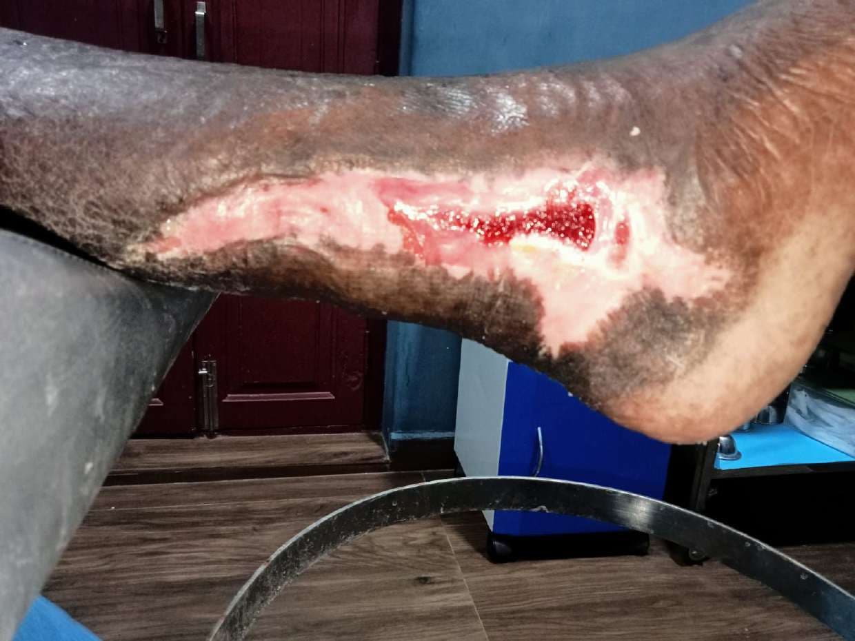 Clinical image 2 from Merina Medical Centre case record