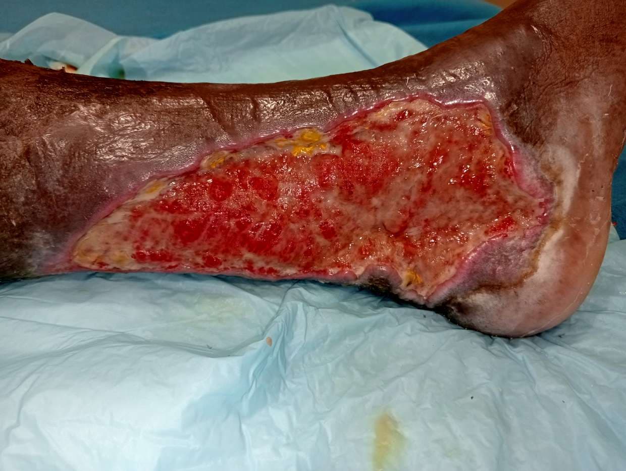 Clinical image 3 from Merina Medical Centre case record