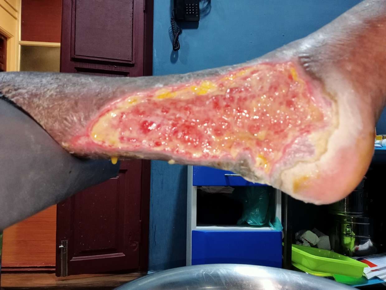 Clinical image 4 from Merina Medical Centre case record