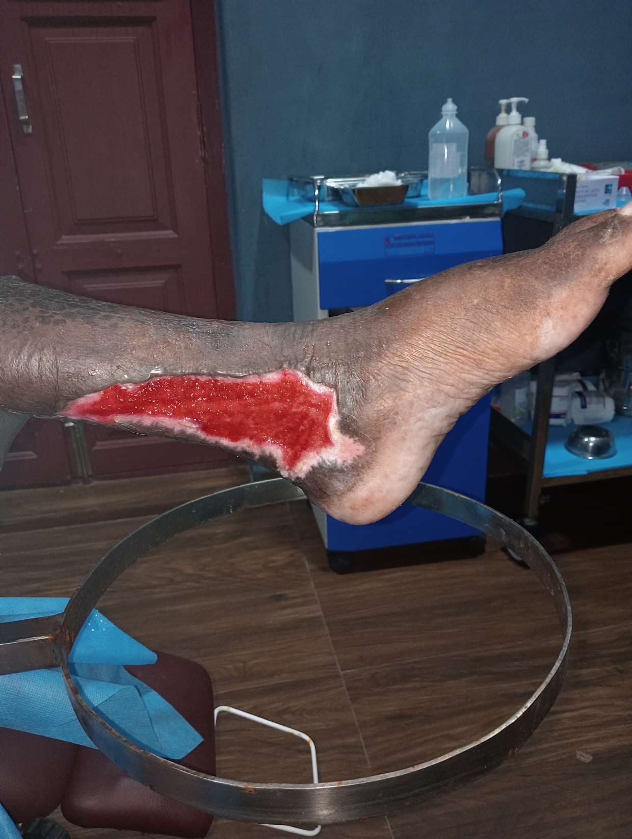 Clinical image 7 from Merina Medical Centre case record