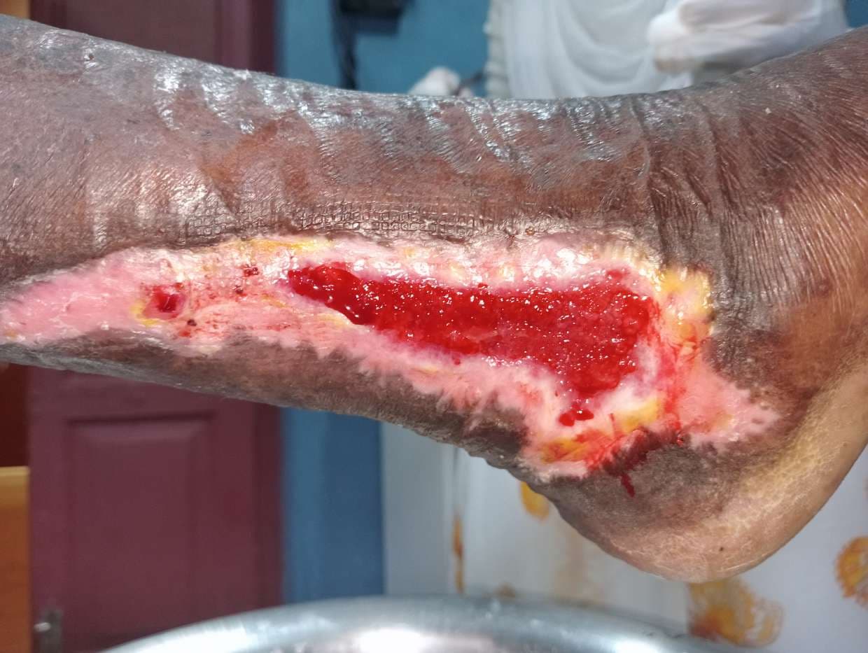 Clinical image 8 from Merina Medical Centre case record