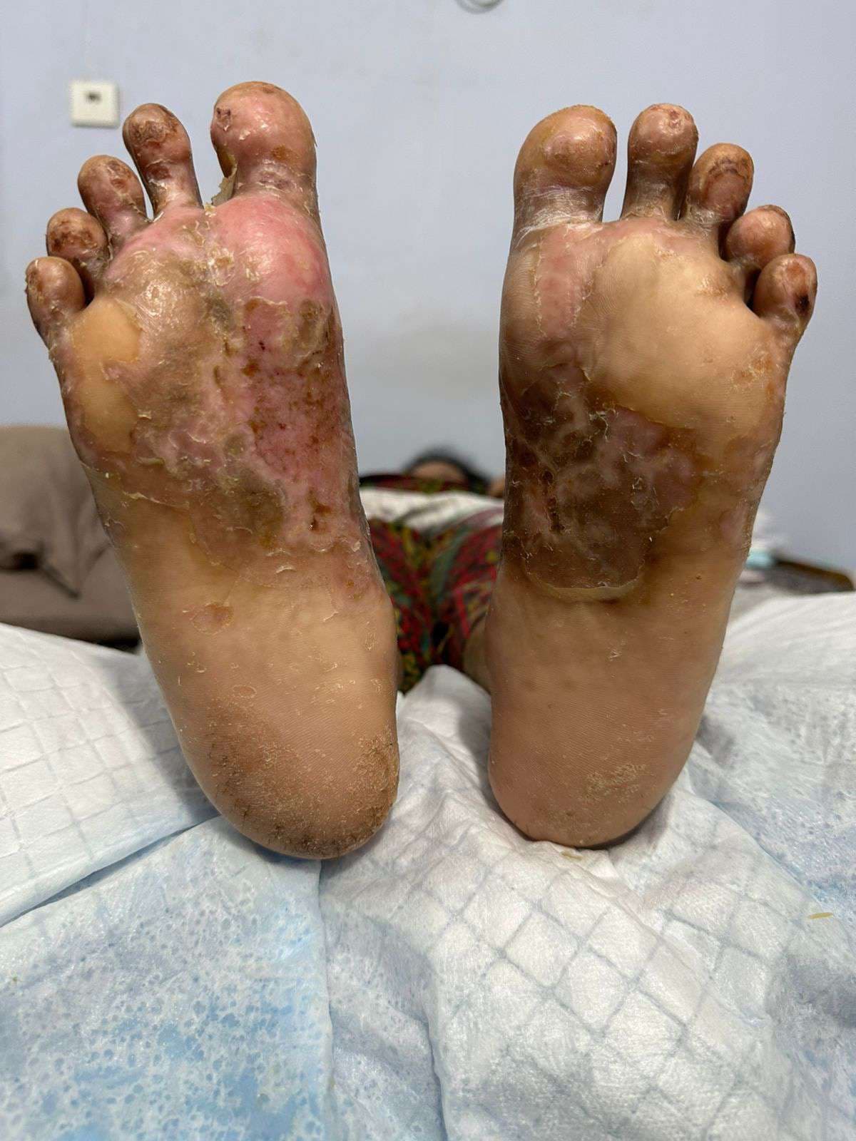 Clinical image 2 from Merina Medical Centre case record